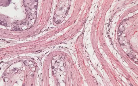 Mikroskopische Aufnahme von Herzmuskelgewebe mit komplexen zellulären Strukturen und organischen Mustern. - Foto: über boerse-global.de
