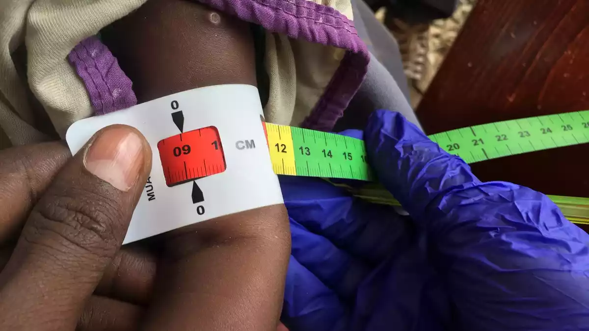 Schon jetzt gelten fast zwei Millionen Kinder in Somalia akut unterernährt. (Archivbild) - Bild: Eva-Maria Krafczyk/dpa