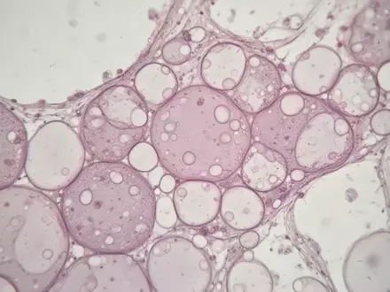Mikroskopische Aufnahme von Fettgewebe mit sichtbaren Zellstrukturen und Lipidtröpfchen in einer Laborumgebung. - Foto: über boerse-global.de