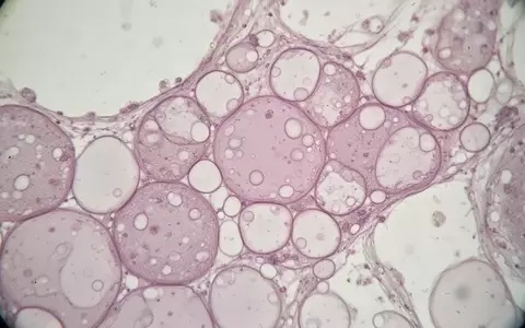 Mikroskopische Aufnahme von Fettgewebe mit sichtbaren Zellstrukturen und Lipidtröpfchen in einer Laborumgebung. - Foto: über boerse-global.de