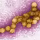 Das West-Nil-Virus unter dem Elektronenmikroskop. (Archivbild) - Bild: Cynthia Goldsmith/CENTERS FOR DISEASE CONTROL/EPA/dpa