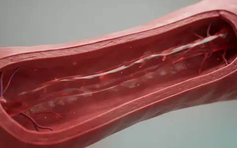 Mikroskopische Nahaufnahme einer gesunden Arterienwand zur Veranschaulichung vaskulärer Gesundheit. - Foto: über boerse-global.de