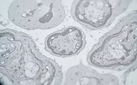 Mikroskopische Aufnahme von biologischem Gewebe mit neutralem, klinischem Fokus zur Darstellung zellulärer Strukturen. - Foto: über boerse-global.de