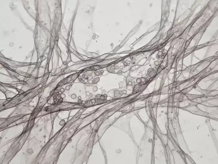 Mikroskopische Aufnahme von biologischem Gewebe mit sichtbaren Faserstrukturen und Zellverbänden. - Foto: über boerse-global.de