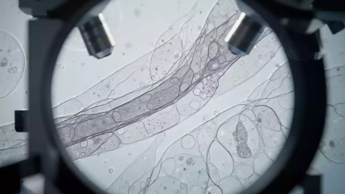 Endometriose: Yale-Studie verknüpft IL16 mit stärkeren Schmerzen