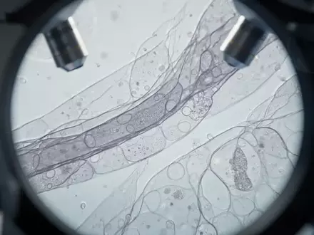 Mikroskopische Aufnahme von biologischem Gewebe mit komplexen Zellstrukturen in einem wissenschaftlichen Labor - Foto: über boerse-global.de