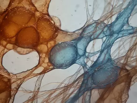 Mikroskopische Aufnahme von biologischem Gewebe und zellulären Strukturen im Rahmen der medizinischen Forschung. - Foto: über boerse-global.de