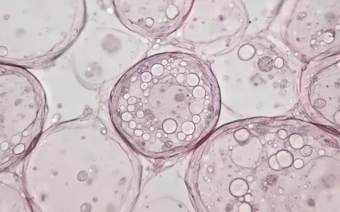 Mikroskopische Nahaufnahme von menschlichem Fettgewebe mit sichtbaren Zellstrukturen und Lipidtröpfchen. - Foto: über boerse-global.de