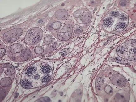 Mikroskopische Aufnahme von Lebergewebe mit Fokus auf zelluläre Strukturen und mitochondriale Netzwerke. - Foto: über boerse-global.de