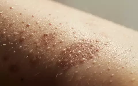 Nahaufnahme einer natürlichen Hautoberfläche mit feiner Textur und sanftem Lichteinfall. - Foto: über boerse-global.de