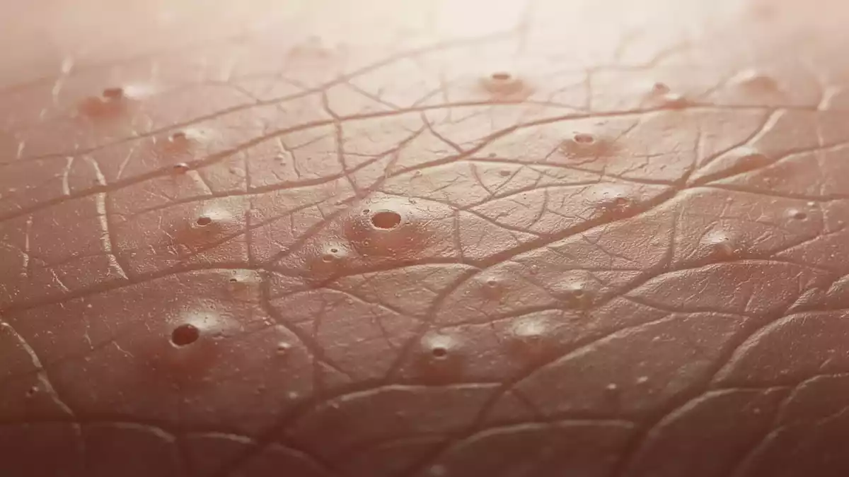 Galderma präsentiert Dreijahresdaten zu Nemolizumab bei Neurodermitis