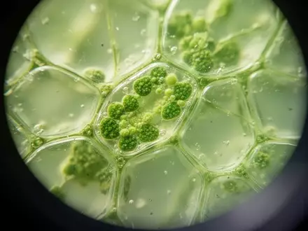 Nahaufnahme von pflanzlichen Zellstrukturen unter einem Mikroskop zur Veranschaulichung biologischer Alterungsprozesse. - Foto: über boerse-global.de