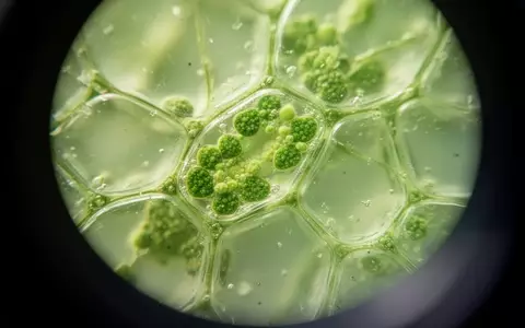 Nahaufnahme von pflanzlichen Zellstrukturen unter einem Mikroskop zur Veranschaulichung biologischer Alterungsprozesse. - Foto: über boerse-global.de