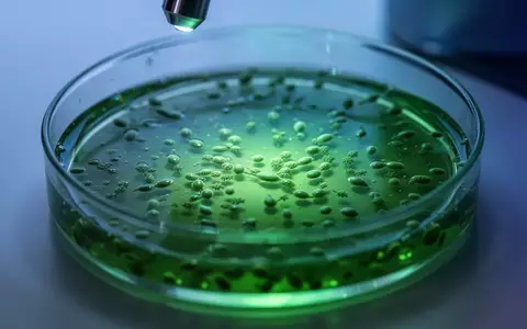 Mikroskopische Nahaufnahme einer grĂĽnen Algenkultur in einer Laborschale unter diffusem Licht als Symbol fĂĽr optogenetische Forschung. - Foto: ĂĽber boerse-global.de