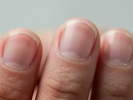 Nahaufnahme menschlicher FingernĂ€gel vor einem unscharfen, neutralen Hintergrund. - Foto: ĂŒber boerse-global.de