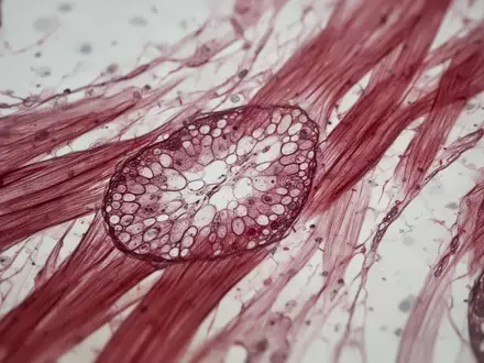 Mikroskopische Aufnahme von biologischem Muskelgewebe mit detaillierter Faserstruktur. - Foto: über boerse-global.de