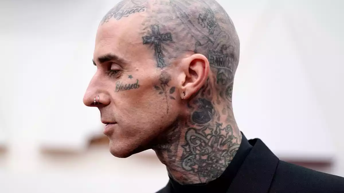 Travis Barker geht davon aus, dass er in ein paar Wochen wieder fit ist. (Archivbild) - Bild: Jae C. Hong/Invision/AP/dpa