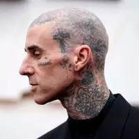 Travis Barker geht davon aus, dass er in ein paar Wochen wieder fit ist. (Archivbild) - Foto: Jae C. Hong/Invision/AP/dpa