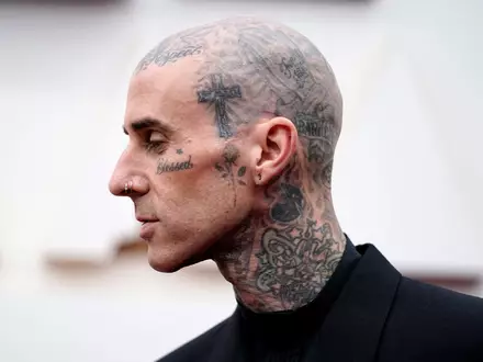 Travis Barker geht davon aus, dass er in ein paar Wochen wieder fit ist. (Archivbild) - Foto: Jae C. Hong/Invision/AP/dpa