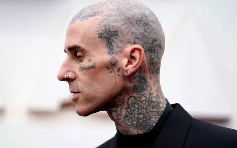 Travis Barker geht davon aus, dass er in ein paar Wochen wieder fit ist. (Archivbild) - Foto: Jae C. Hong/Invision/AP/dpa