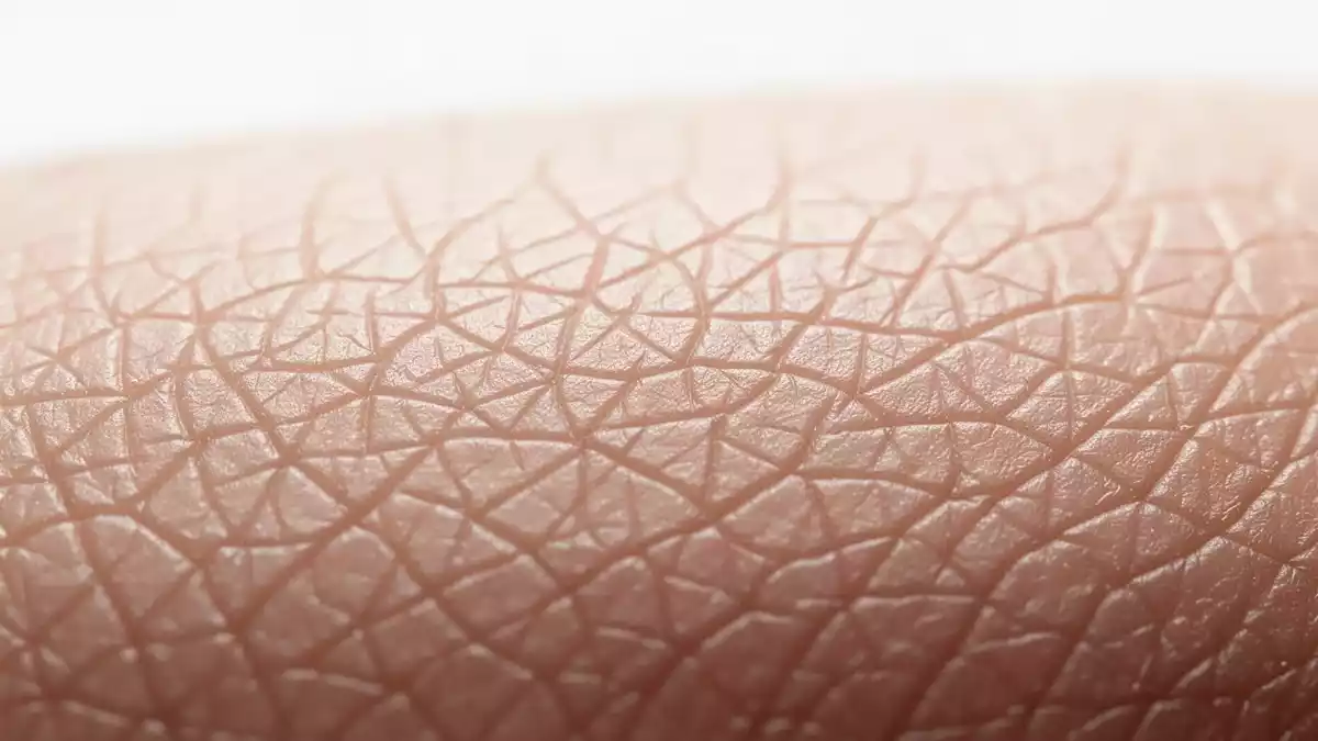 Eli Lilly: Kombitherapie zeigt breitere Biomarker-Effekte bei Psoriasis