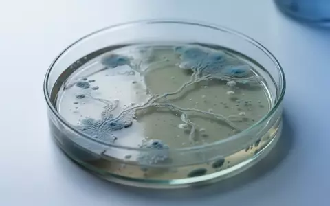 Nahaufnahme einer Laborschale mit Nährboden und mikrobiellen Kulturen in einem klinischen Umfeld. - Foto: über boerse-global.de