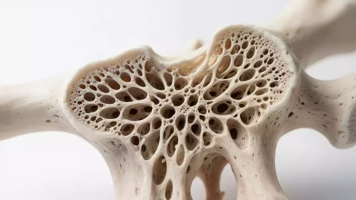 ASCO aktualisiert Osteoporose-Leitlinien mit neuen Therapiewegen