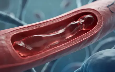 Nahaufnahme einer Arterienwand mit fließendem Blutplasma zur Veranschaulichung kardiovaskulärer Forschung. - Foto: über boerse-global.de