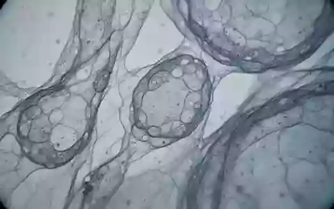 Mikroskopische Aufnahme von biologischem Gewebe mit komplexen zellulären Strukturen in bläulichen und grauen Farbtönen. - Foto: über boerse-global.de