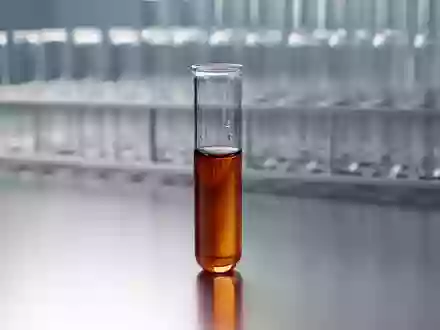 Ein medizinisches Probenröhrchen mit Serum steht auf einer sterilen Metalloberfläche in einem Labor. - Foto: über boerse-global.de