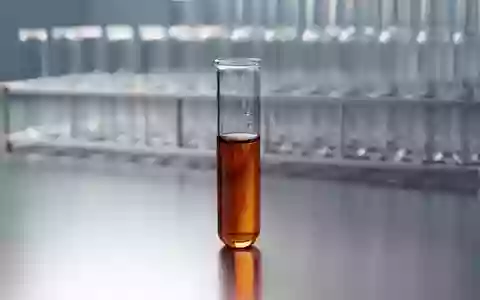 Ein medizinisches Probenröhrchen mit Serum steht auf einer sterilen Metalloberfläche in einem Labor. - Foto: über boerse-global.de