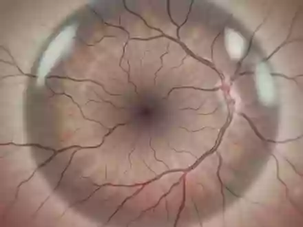 Detailaufnahme der komplexen Gefäßstrukturen im menschlichen Auge zur Untersuchung retinaler Biomarker. - Foto: über boerse-global.de