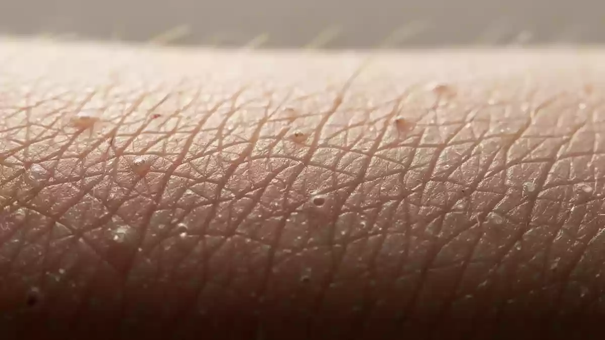 Diabetes und Haut: Acht Veränderungen können auf Störungen hinweisen