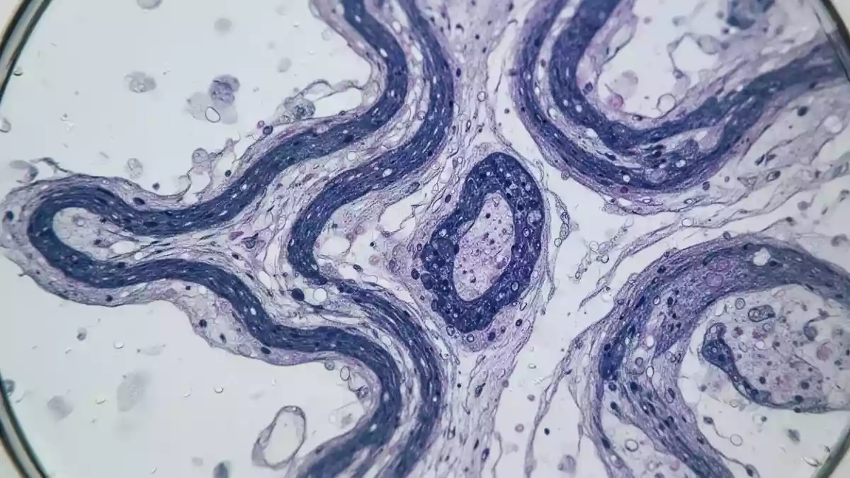 BPH-Forschung: WIF1-Bas cells als möglicher Faktor bei Prostatawachstum