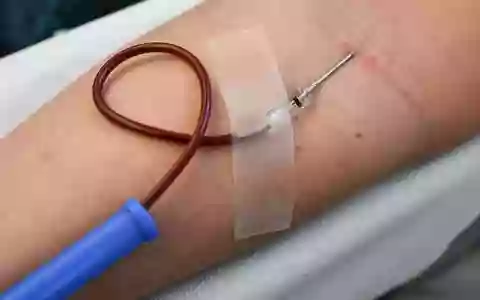 Nur gesunde Menschen sollten Blut spenden. (Symbolbild) - Foto: Jens Kalaene/dpa