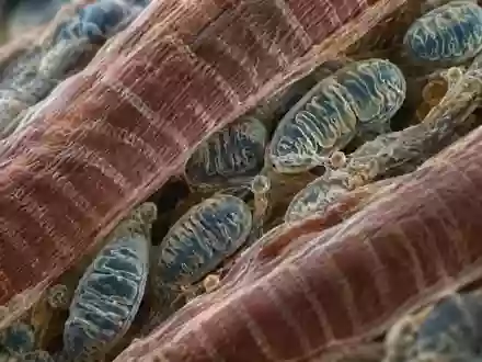 Mikroskopische Aufnahme von Muskelgewebestrukturen und Mitochondrien bei hoher Vergrößerung. - Foto: über boerse-global.de