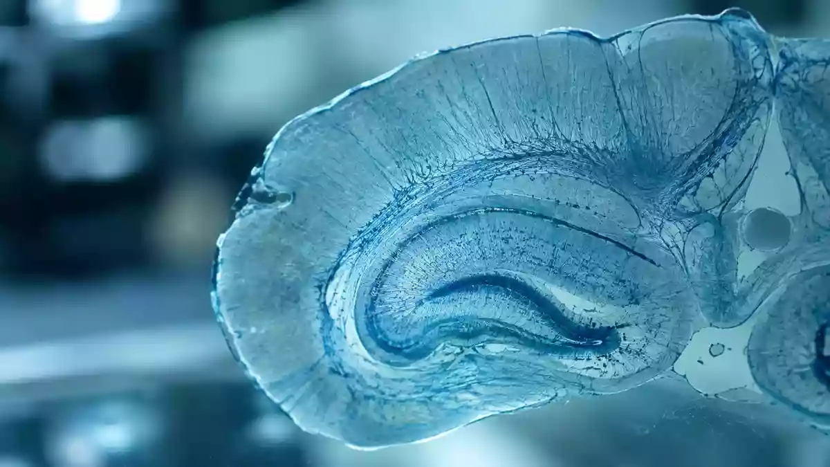 Mikroskopische Aufnahme von Hirngewebe mit feinen neuronalen Strukturen in einer wissenschaftlichen Laborumgebung. Illustration mit AI erstellt.