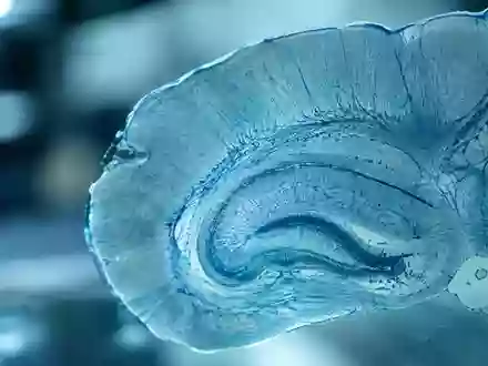 Mikroskopische Aufnahme von Hirngewebe mit feinen neuronalen Strukturen in einer wissenschaftlichen Laborumgebung. - Foto: über boerse-global.de