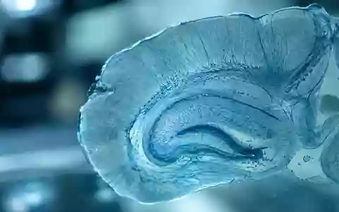 Mikroskopische Aufnahme von Hirngewebe mit feinen neuronalen Strukturen in einer wissenschaftlichen Laborumgebung. - Foto: über boerse-global.de