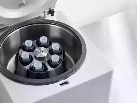 Eine medizinische Laborzentrifuge auf einer Edelstahloberfläche als Symbol für moderne kardiologische Diagnostik. - Foto: über boerse-global.de