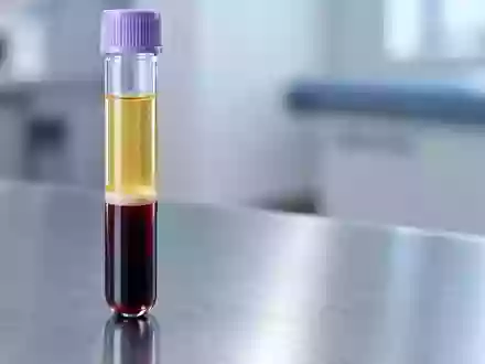 Ein zentrifugiertes Blutröhrchen mit getrenntem Plasma auf einer sterilen Laboroberfläche. - Foto: über boerse-global.de