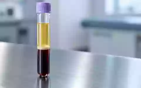 Ein zentrifugiertes Blutröhrchen mit getrenntem Plasma auf einer sterilen Laboroberfläche. - Foto: über boerse-global.de