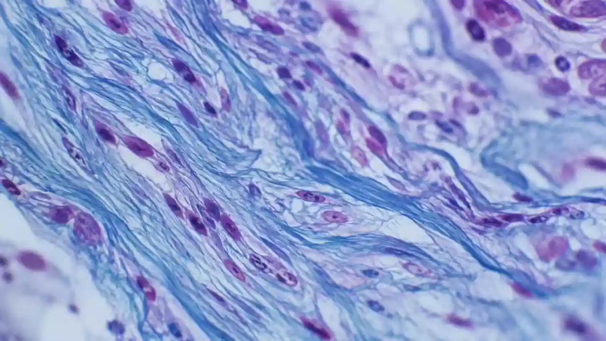 Mikroskopische Aufnahme von biologischem Gewebe mit faserartigen Strukturen in klinisch-kühlen Farbtönen. Illustration mit AI erstellt.