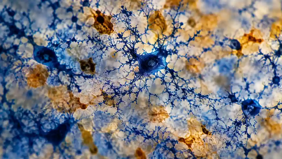 Mikroskopische Aufnahme von Mikroglia-Zellen in neuralem Gewebe, die die immunologischen Strukturen des Gehirns verdeutlicht. Illustration mit AI erstellt.