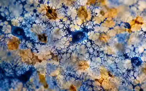 Mikroskopische Aufnahme von Mikroglia-Zellen in neuralem Gewebe, die die immunologischen Strukturen des Gehirns verdeutlicht. - Foto: über boerse-global.de