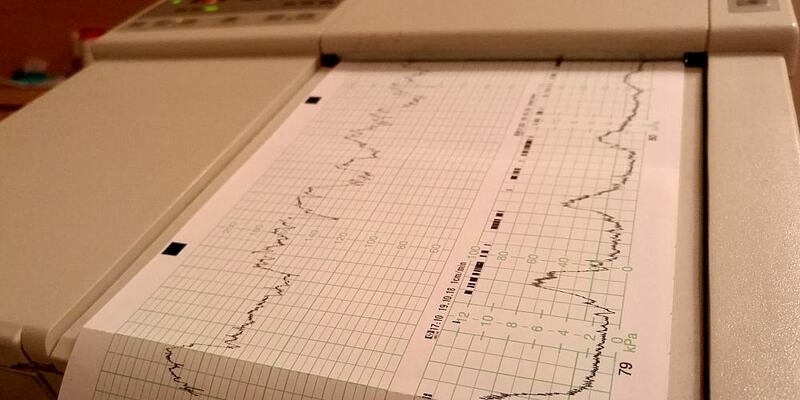 Kardiotokografie im Krankenhaus (Archiv) - Foto: über dts Nachrichtenagentur