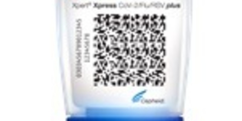 Das Start-up Circu Li-ion und Amazon wollen gemeinsam die Lebensdauer von Batterien in Logistikprozessen verlängern - Foto: presseportal.de