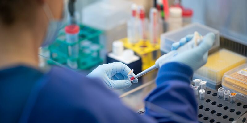 Der Ursprung des Virus Sars-CoV-2 bleibt unklar. (Symbolbild) - Foto: Daniel Reinhardt/dpa