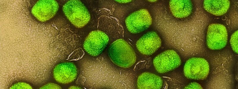 In Deutschland ist zum zweiten Mal die neue Variante des Mpox-Virus nachgewiesen worden. (Archivbild) - Foto: Niaid/Niaid/Planet Pix via ZUMA Press Wire/dpa