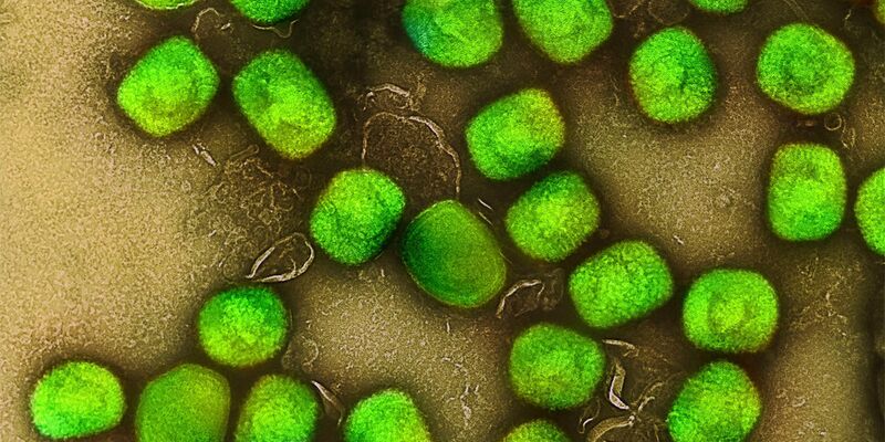 Mpox breiten sich in der Regel über engen Körperkontakt aus. (Archivbild) - Foto: Niaid/Niaid/Planet Pix via ZUMA Press Wire/dpa